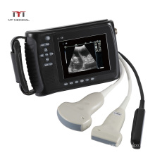 Multi-probe Full Digital Portable Handheld Vet Animal Ultrasound Scanner Machine